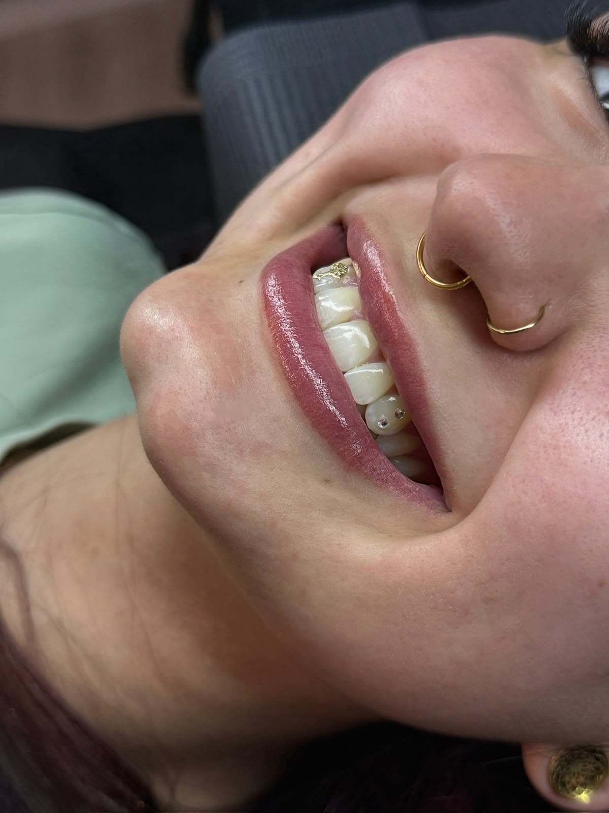 Tooth Gems zwei Kristalle Seitenansicht