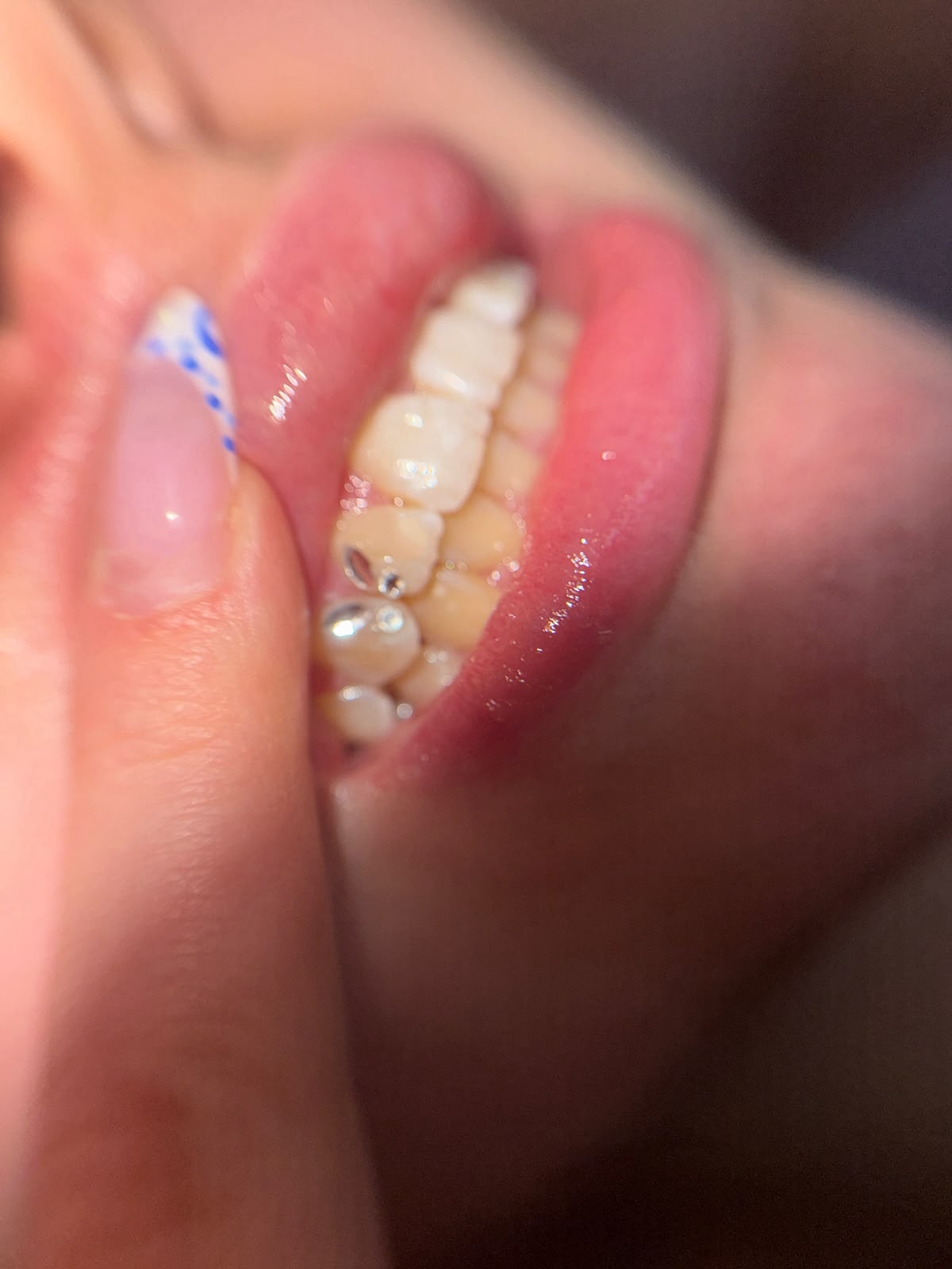 Tooth Gems Silber Cluster seitlich