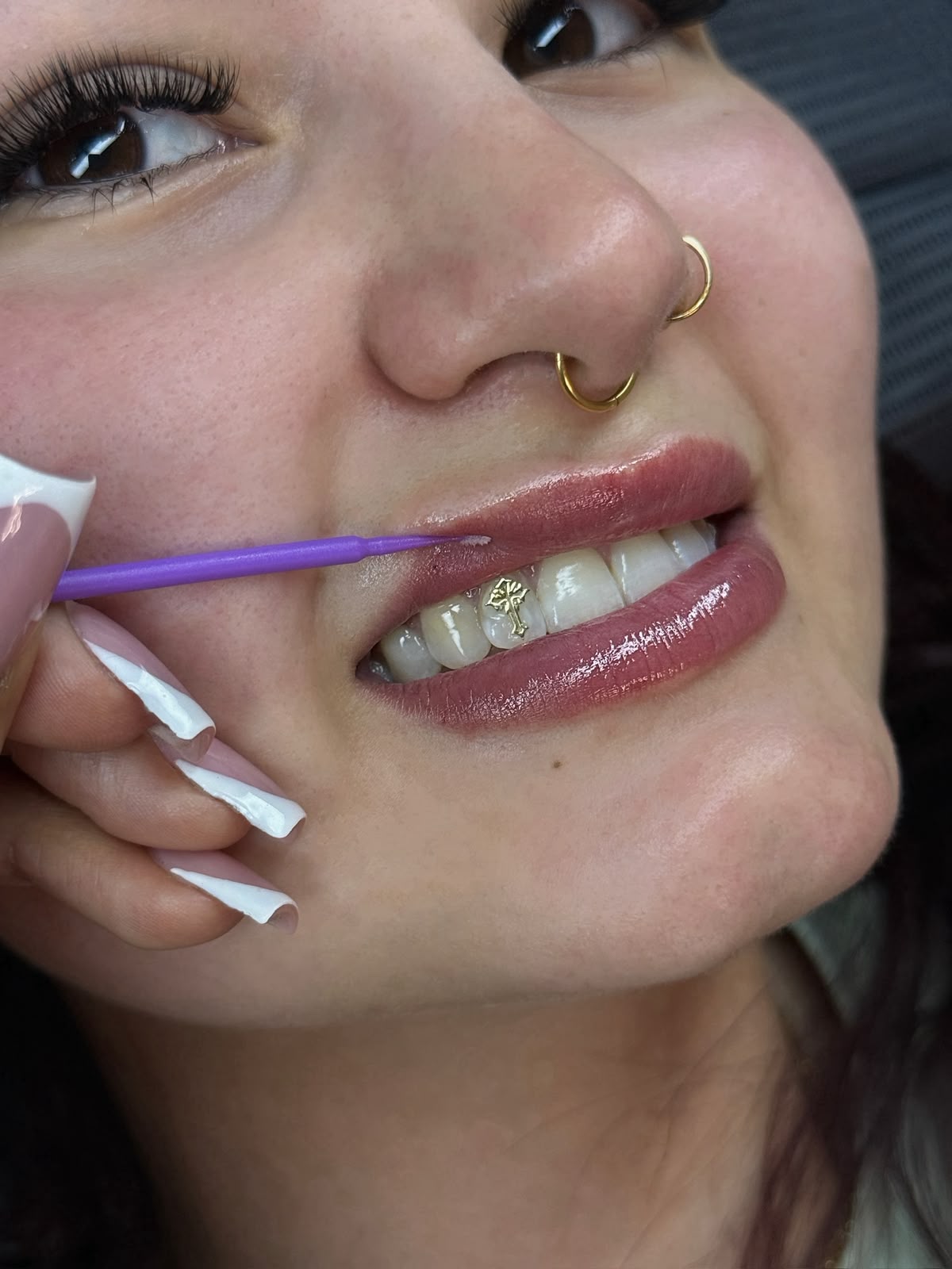 Tooth Gems Gold Charm und Kristalle