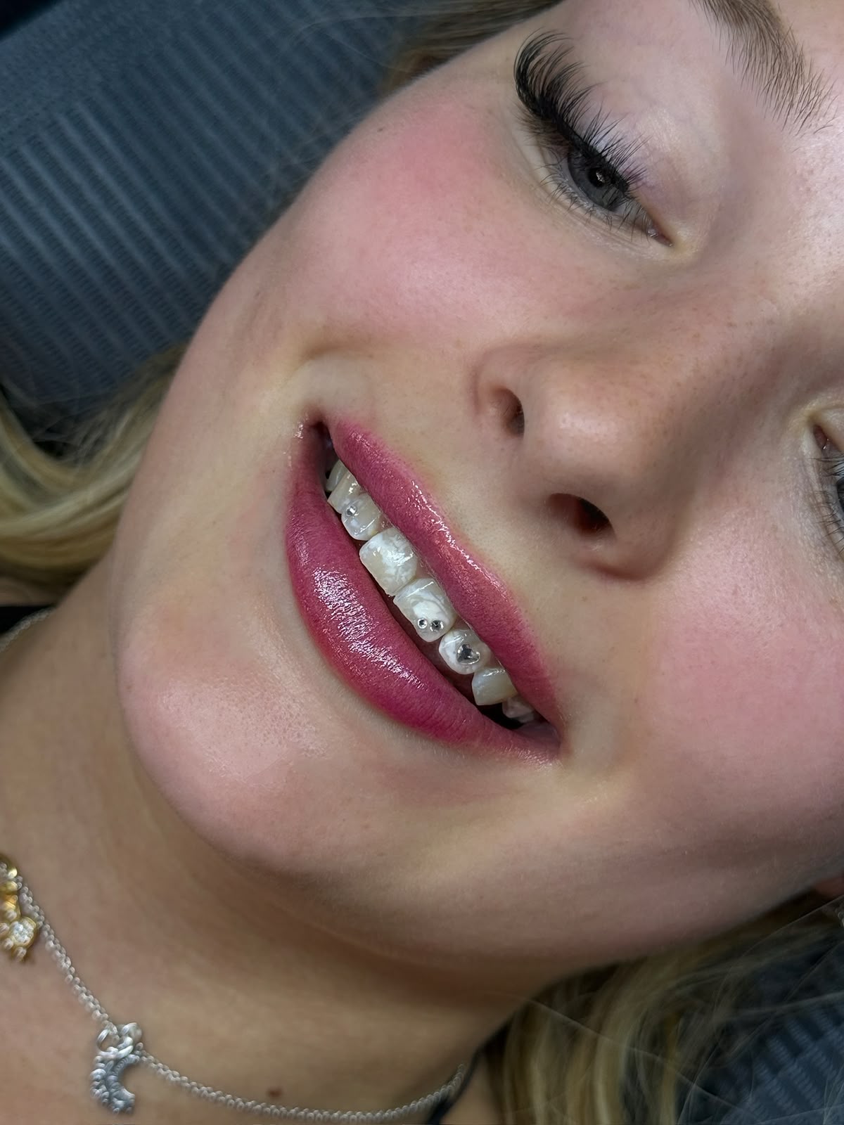 Tooth Gems lächelnd mit silbernem Kristall