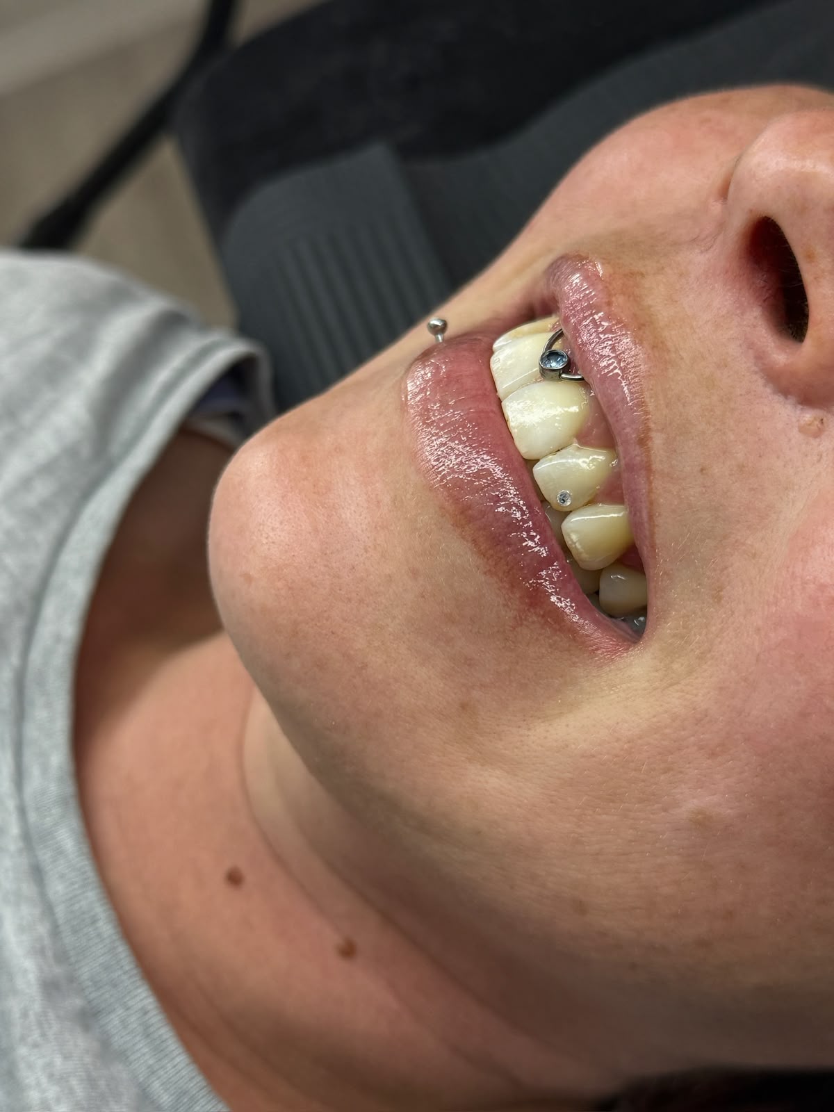 Tooth Gems Aquamarin Kristall am Eckzahn