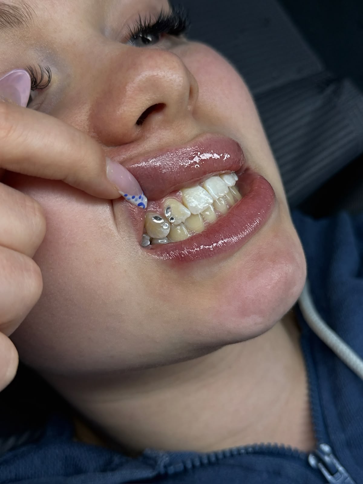 Tooth Gems Herz Kristall Frontansicht